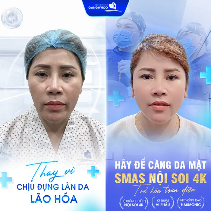 5 Nơi Căng Da Mặt Ở Kiên Giang Giúp Bạn Trẻ Lại 10 Tuổi