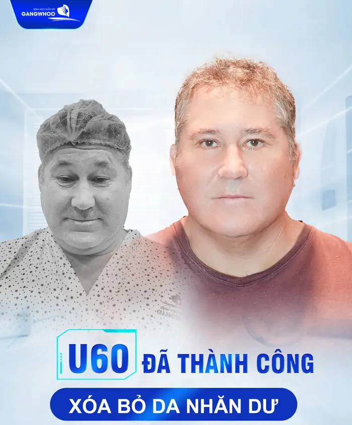 5 Nơi Căng Da Mặt Ở Kiên Giang Giúp Bạn Trẻ Lại 10 Tuổi