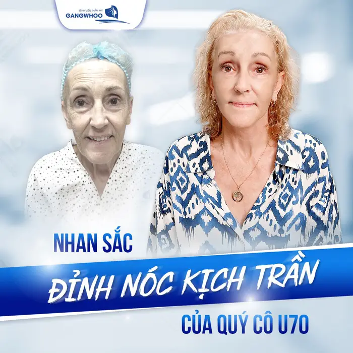 4 Nơi Căng Da Mặt Ở Cao Bằng Lựa Chọn Cho Làn Da Đẹp Tươi Trẻ