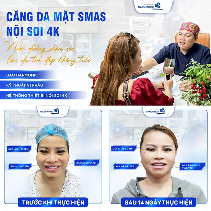 Say Bye Da Lão Hoá Với Top 5 Cơ Sở Căng Da Mặt Ở Bạc Liêu Này