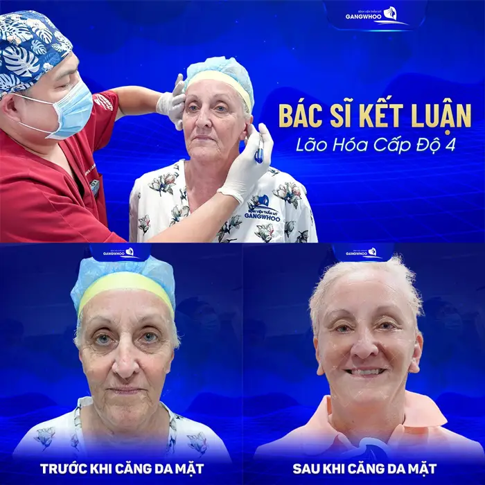 Tại Sao Nên Căng Da Mặt Ở Tây Ninh Tại 4 Cơ Sở Này Ngay Hôm Nay!