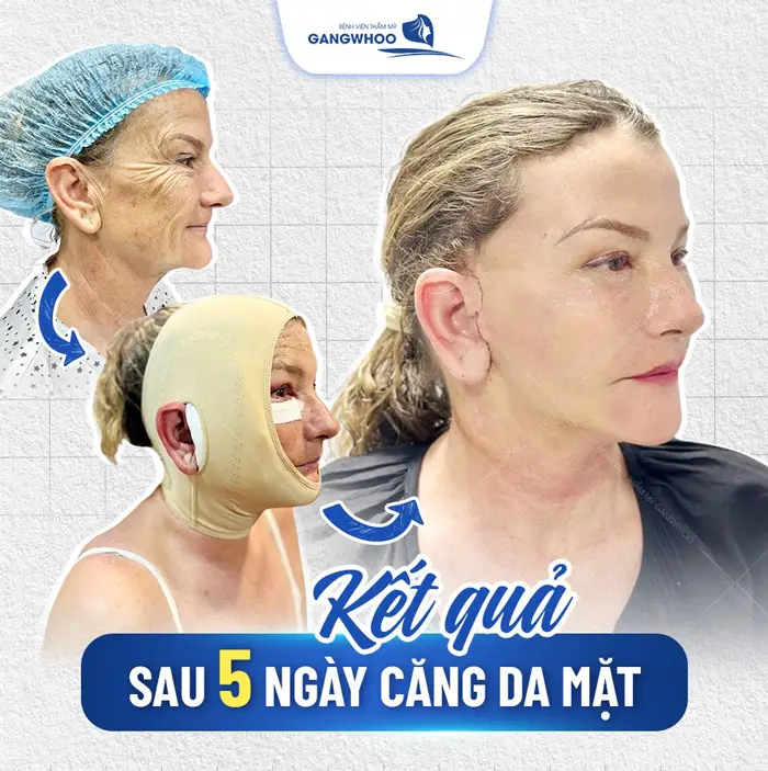 Khám Phá 4 Cơ Sở Căng Da Mặt Ở Bắc Kạn Uy Tín & Hiệu Quả