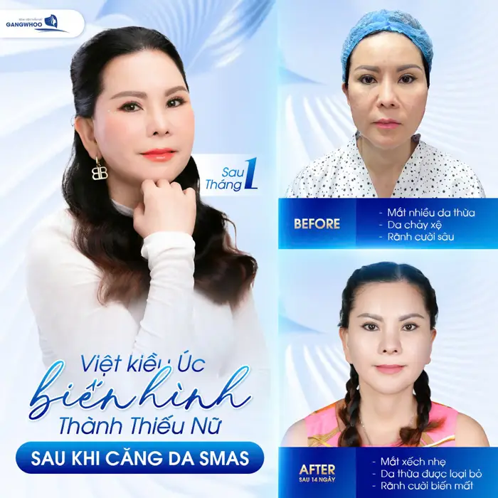 Khám Phá 4 Cơ Sở Căng Da Mặt Ở Bắc Kạn Uy Tín & Hiệu Quả