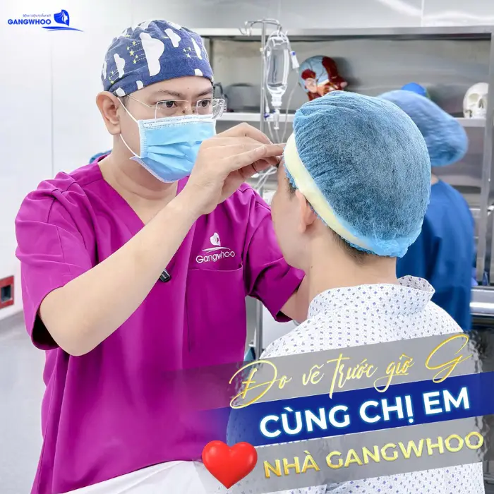 Bác sĩ đánh dấu vùng cấy mỡ để tối ưu hiệu quả làm đầy