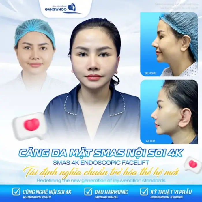 Hiệu quả căng da mặt 4D giúp làn da săn chắc và trẻ trung hơn