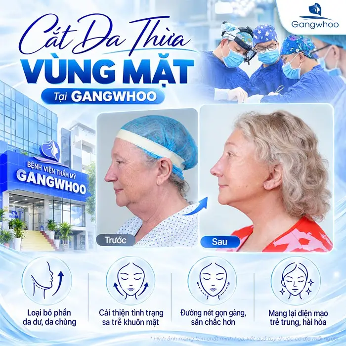 Cắt da thừa vùng mặt: Ưu điểm và quy trình thực hiện