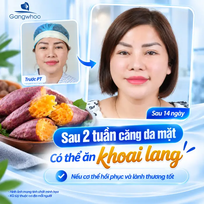 Căng Da Mặt Ăn Khoai Lang Được Không? Bác Sĩ Giải Đáp Chi Tiết