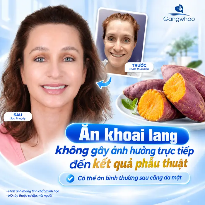 Căng Da Mặt Ăn Khoai Lang Được Không? Bác Sĩ Giải Đáp Chi Tiết