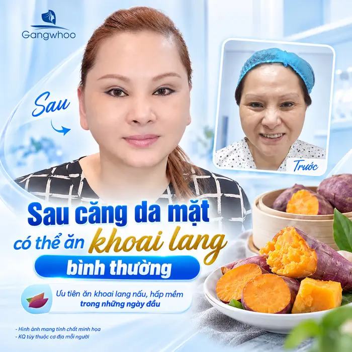 Căng Da Mặt Ăn Khoai Lang Được Không? Bác Sĩ Giải Đáp Chi Tiết