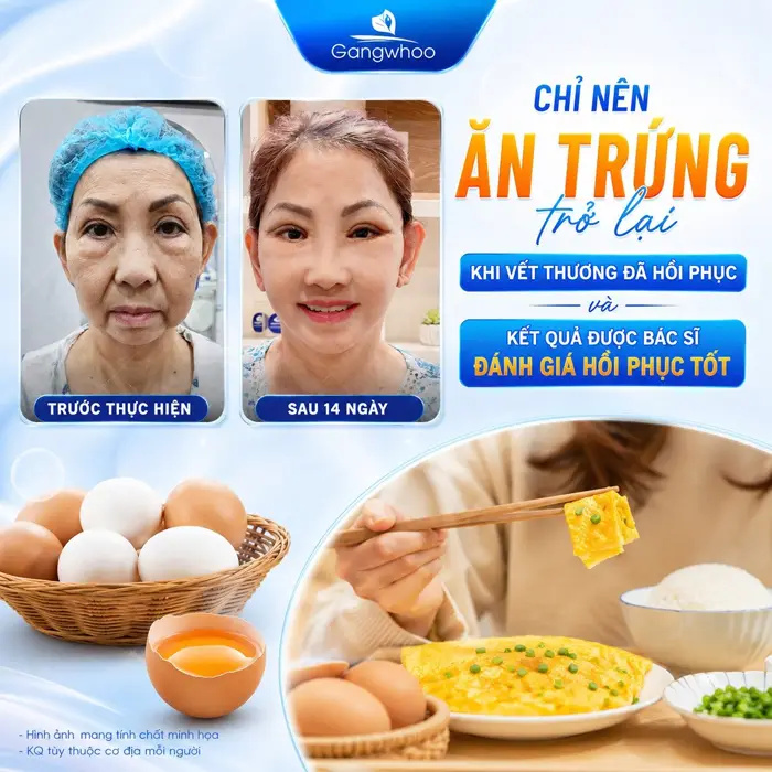 Căng Da Mặt Có Được Ăn Trứng Không? Bác Sĩ Giải Đáp Theo Góc Nhìn Y Khoa