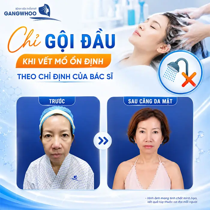 Căng Da Mặt Bao Lâu Được Gội Đầu? Thời Điểm An Toàn Theo Bác Sĩ