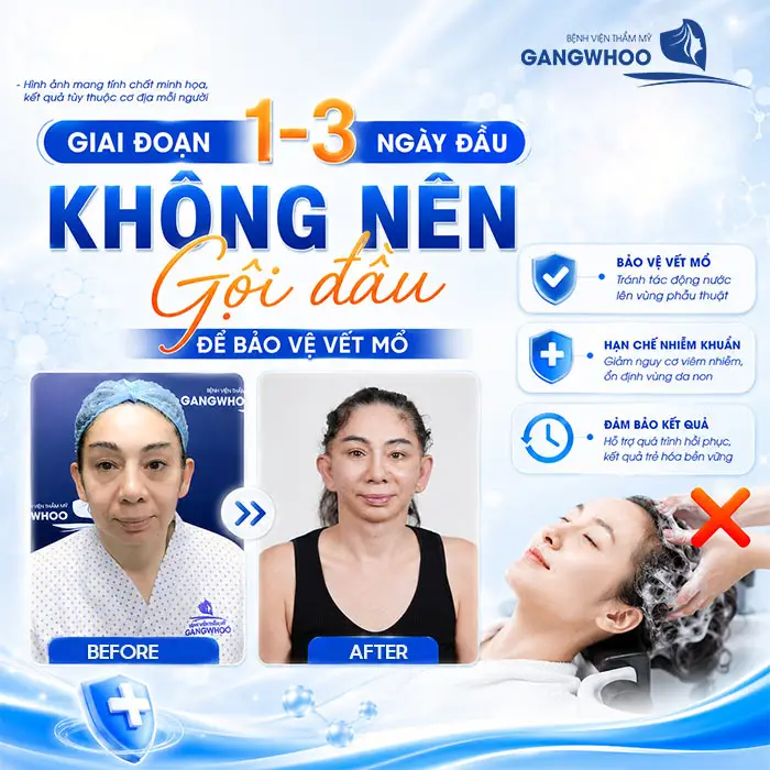 Căng Da Mặt Bao Lâu Được Gội Đầu? Thời Điểm An Toàn Theo Bác Sĩ