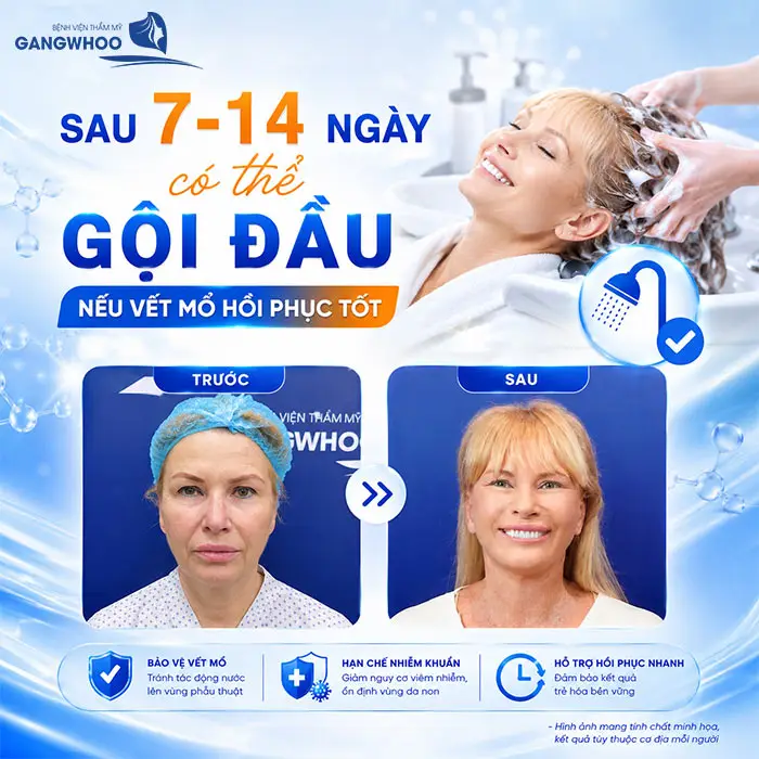 Căng Da Mặt Bao Lâu Được Gội Đầu? Thời Điểm An Toàn Theo Bác Sĩ