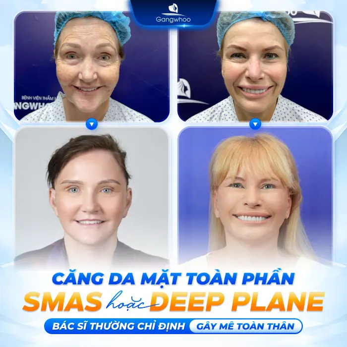 Căng Da Mặt Có Gây Mê Không? Giải Đáp Chi Tiết Từ Bác Sĩ
