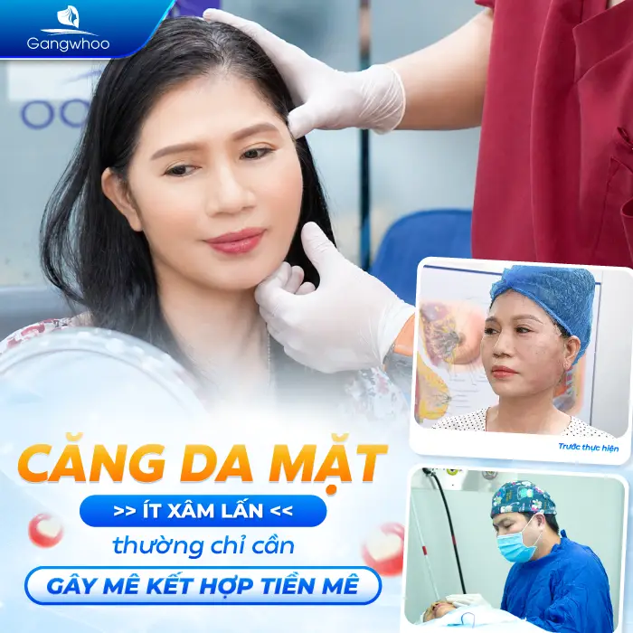 Căng Da Mặt Có Gây Mê Không? Giải Đáp Chi Tiết Từ Bác Sĩ