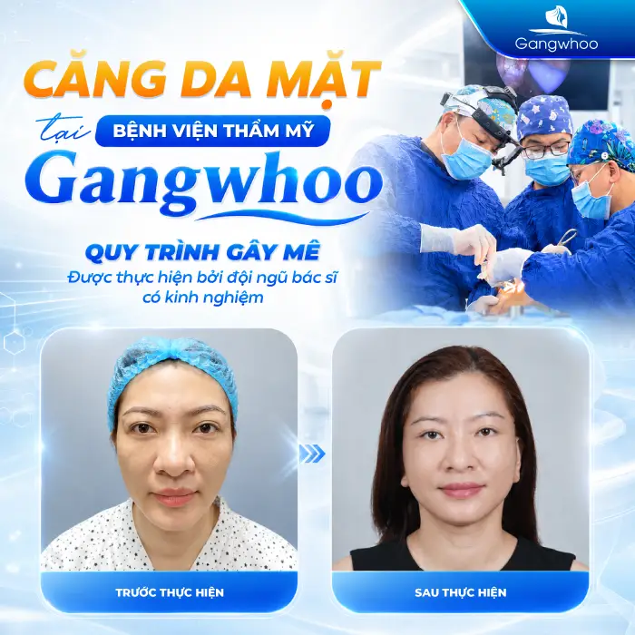 Căng Da Mặt Có Gây Mê Không? Giải Đáp Chi Tiết Từ Bác Sĩ