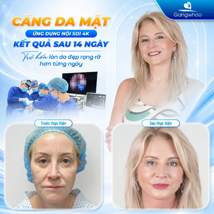 Căng Da Mặt Có Gây Mê Không? Giải Đáp Chi Tiết Từ Bác Sĩ