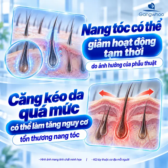 Căng Da Mặt Tóc Bao Lâu Mọc Lại? Bác Sĩ Giải Đáp Chi Tiết Từ Góc Độ Chuyên Môn