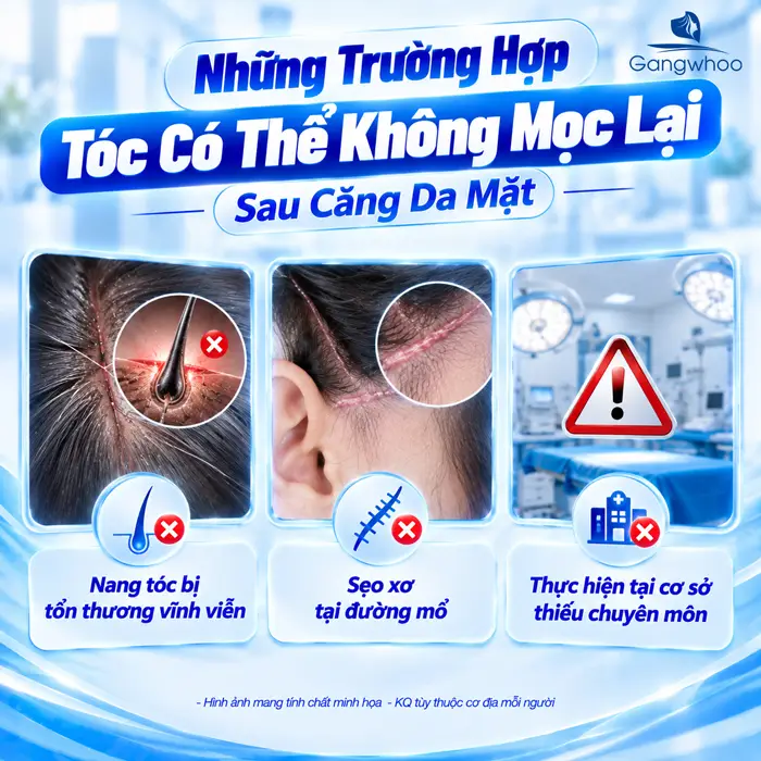 Căng Da Mặt Tóc Bao Lâu Mọc Lại? Bác Sĩ Giải Đáp Chi Tiết Từ Góc Độ Chuyên Môn