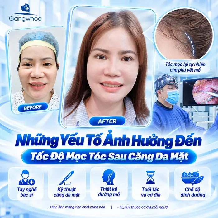 Căng Da Mặt Tóc Bao Lâu Mọc Lại? Bác Sĩ Giải Đáp Chi Tiết Từ Góc Độ Chuyên Môn