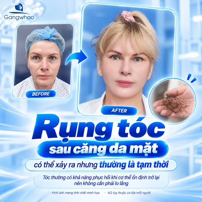Căng Da Mặt Tóc Bao Lâu Mọc Lại? Bác Sĩ Giải Đáp Chi Tiết Từ Góc Độ Chuyên Môn